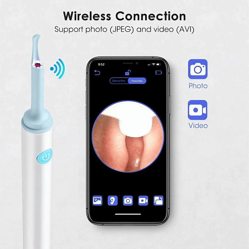 WaxAway Plus™ - Electric Earwax Remover